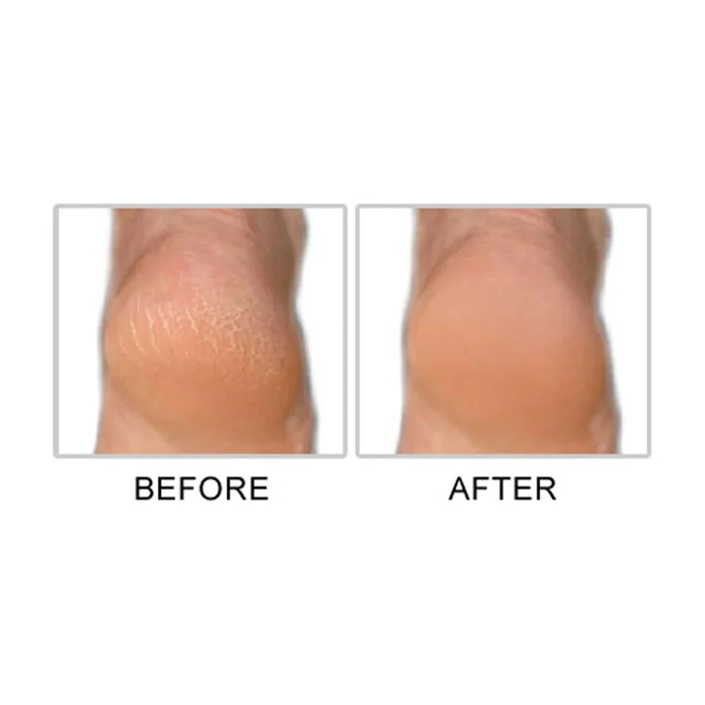 Mr. Pumice Callus Terminator 4oz - Image 3